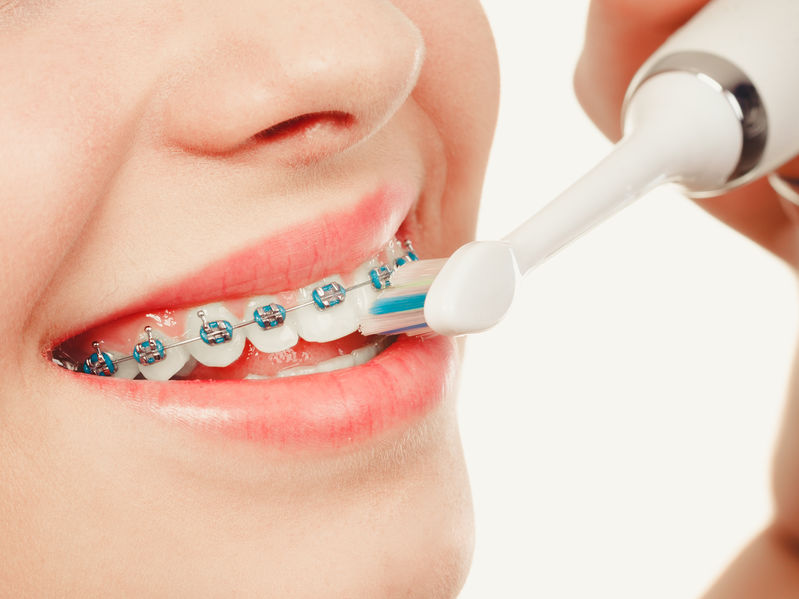 Braces101 BuoyancyOrtho Tustin